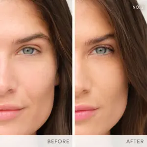 Jane Iredale EnlightenPlus Before After NO2