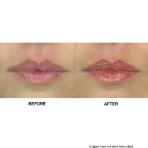 Team Dr Joseph Lip Balm
