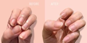Londontown-Lakur-Fortifying-Ridge-Filler-before-and-after-medium-kosmetikshop.ch